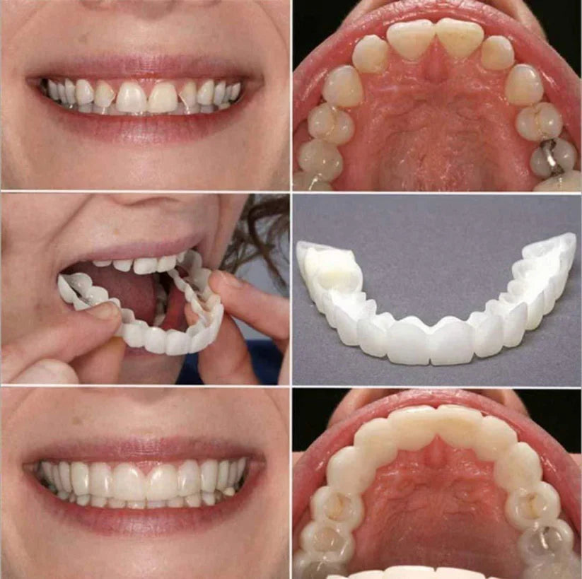 UB™ Smile Fit Flex Teeth Denture
