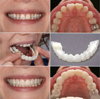 UB™ Smile Fit Flex Teeth Denture