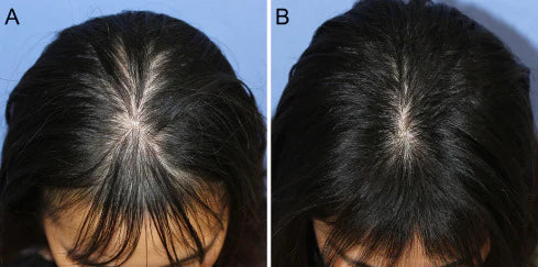 UB™ Adivasi Herbal Hair Oil