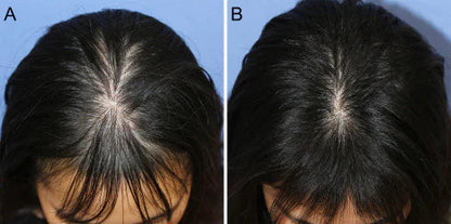 UB™ Adivasi Herbal Hair Oil