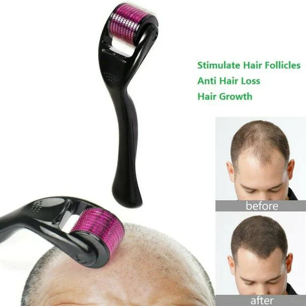 UB™ Derma Roller-For Hair Growth and Facial Skin Therapy