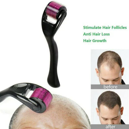UB™ Derma Roller-For Hair Growth and Facial Skin Therapy